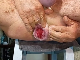 扩肛侠2025-14 free cheerful asian coitus videos